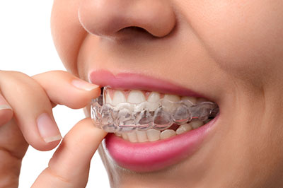 Aberdeen Family Dentistry | Ceramic Crowns, Night Guards and Veneers