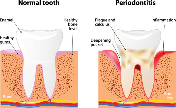 Aberdeen Family Dentistry | Dentures, Oral Exams and Dental Bridges