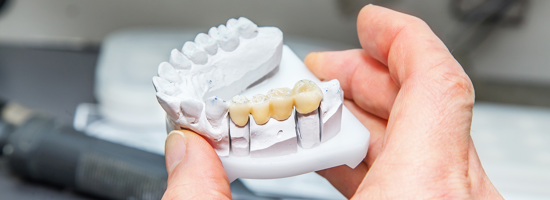 Aberdeen Family Dentistry | Periodontal Treatment, Preventative Program and Pediatric Dentistry